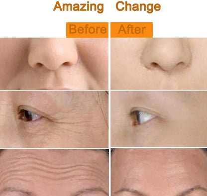 24K Gold Energy Beauty Bar Electric Facial Massage Roller